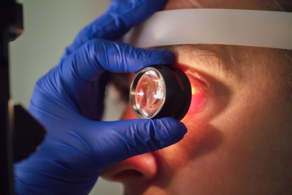 Dilated eye examination for glaucoma screening with specialized lens